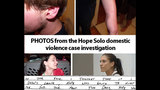 PHOTOS: Hope Solo domestic violence case&hellip; - (3/20)