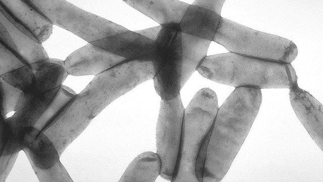 레지오넬라 균에 감염된 3명 발견, 그중 2 명은 워싱턴 주립대학 병원에서 감염돼