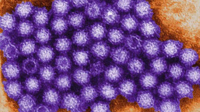 노로바이러스 발생으로 타코마 시니어 커뮤니티의 40여명의 직원들과 주민들 감염